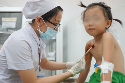 Bé trai nghịch súng săn bắn 10 viên đạn trúng người em gái