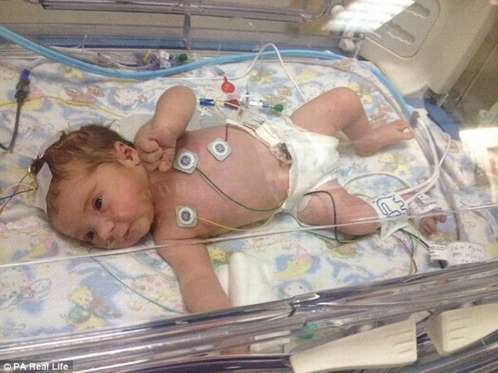 Bé sơ sinh hồi sinh kỳ diệu sau 10 phút ngừng thở