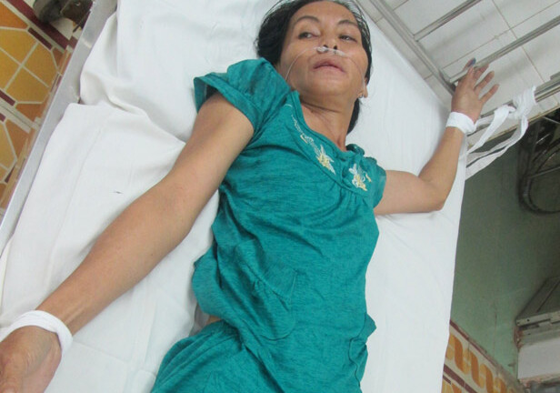 Sức khỏe bé sơ sinh 11 ngày tuổi bị đâm xuyên sọ đang dần ổn định