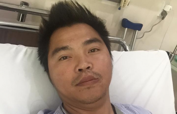 Lê Minh MTV bị tai nạn xe máy gãy xương đùi