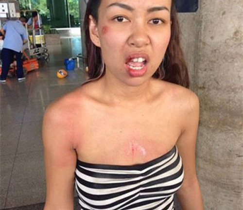 Dồn dập những vụ cướp nhắm vào nghệ sỹ, người nổi tiếng và câu hỏi bỏ lửng