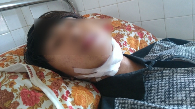 Nam sinh bị công an xã đánh gãy răng và xương hàm?