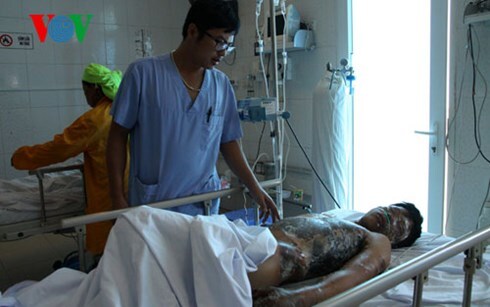 3 trẻ chăn trâu bị điện giật bỏng nặng