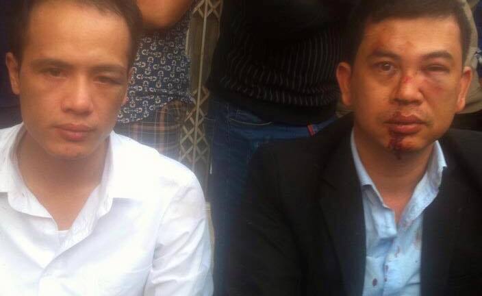 Giám đốc Công an Hà Nội chỉ đạo điều tra  vụ 2 LS bị đánh