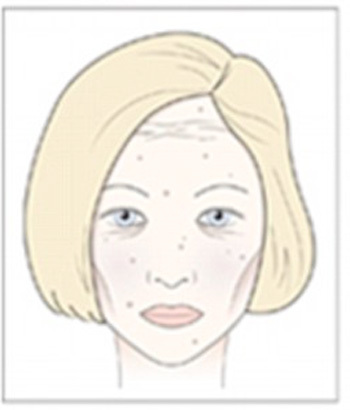 Thói quen ăn nhiều đường sẽ hủy hoại nhan sắc như thế nào?