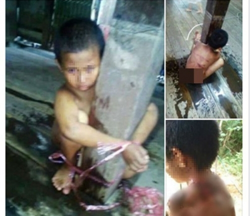 Sự thật phía sau bức ảnh em bé bị dì ghẻ hành hạ, trói vào cột