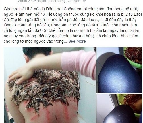 Trị đậu lào bằng lông gà: Rất phản khoa học