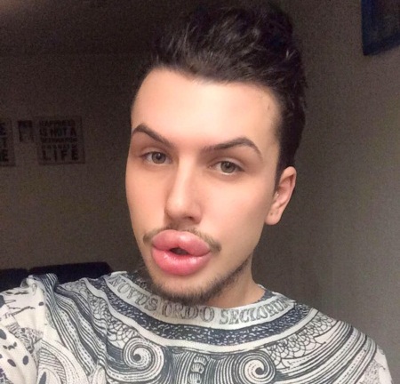 Chàng trai chi hàng trăm triệu thẩm mỹ giống cô Kim siêu vòng 3