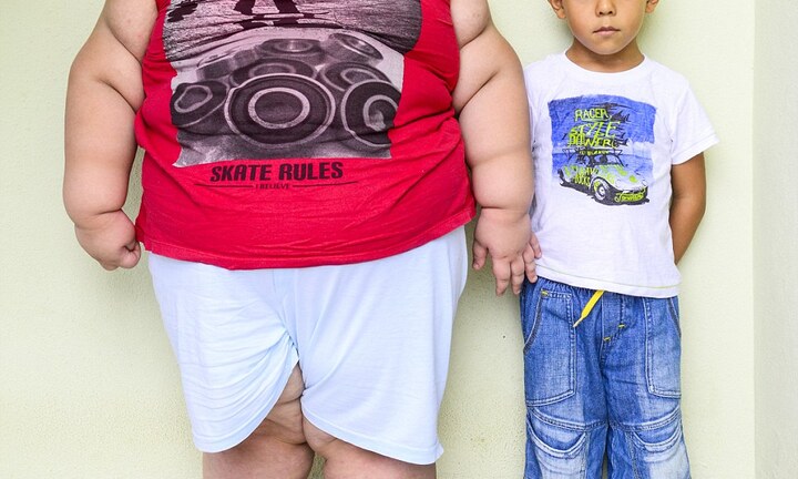 Bé trai 5 tuổi nặng 80 cân có thể thiệt mạng vì quá béo