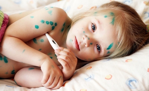 Dấu hiệu, triệu chứng và cách điều trị bệnh thủy đậu cho cả người lớn và trẻ em