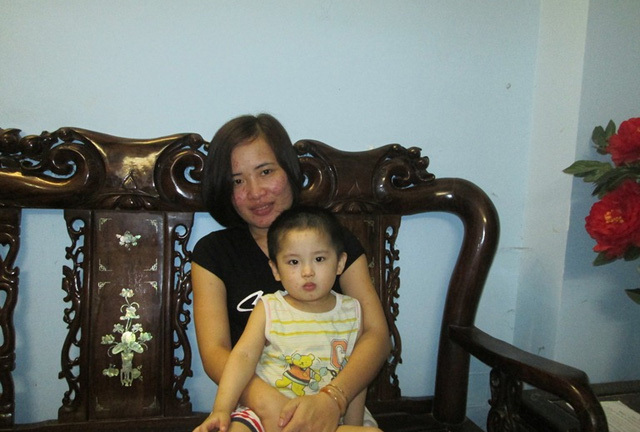 T�nh y�u b?t t? c?a ng??i v? sinh con t? tinh tr�ng ch?ng qu� c?