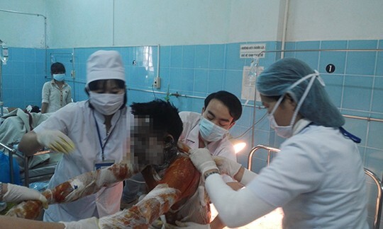 Bình Định: Cha tưới xăng đốt mình và con gái nguy kịch