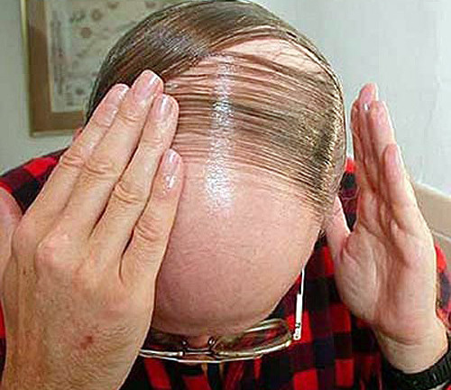 Phát hiện gien tái tạo tóc, da