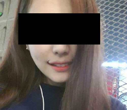 Quy trình cắt miệng xinh như