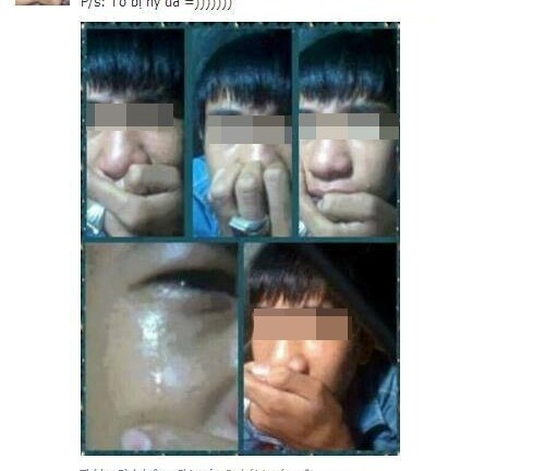 Khóc để... khoe nhẫn, nam thanh niên bị