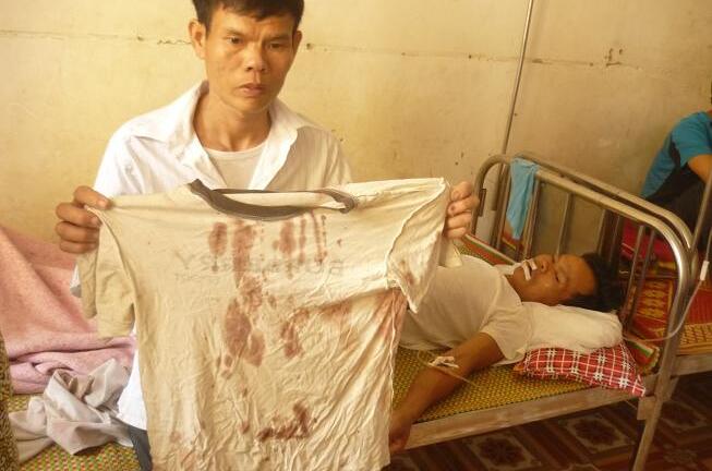 Chưa đền bù đủ, còn đánh dân gãy…7 răng