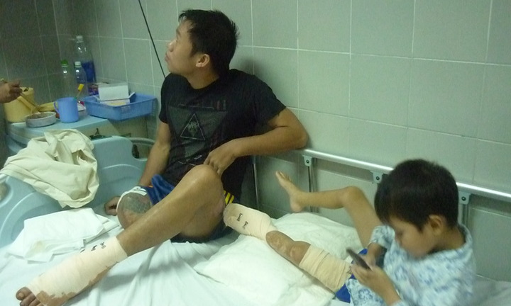 Lời kể hãi hùng của nam thanh niên không biết vì sao mình bị tàu cán đứt chân