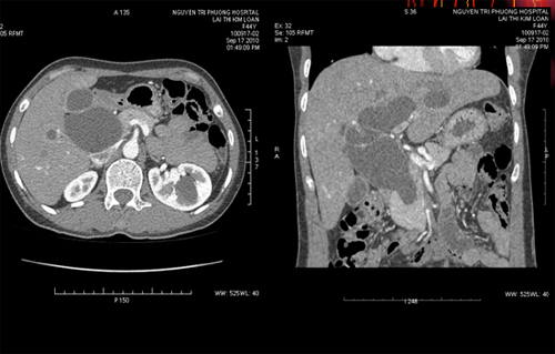 Bệnh viện Nguyễn Tri Phương mắc hàng loạt sai phạm