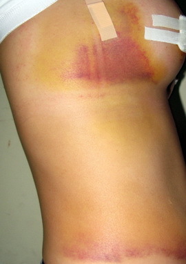 Tâm sự đau đớn của một phụ nữ đi nâng