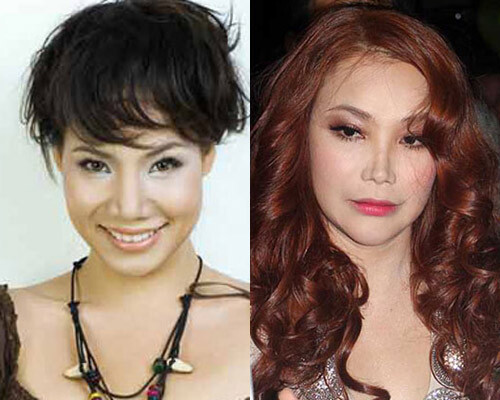 Ngắm 5 mỹ nhân Việt trước và sau phẫu thuật thẩm mỹ