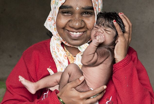 Kỳ lạ bé mới sinh đã mọc lông như