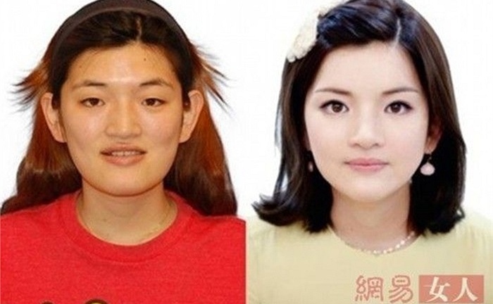 Kinh ngạc công nghệ phẫu thuật biến