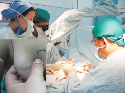 Phẫu thuật thẩm mỹ: