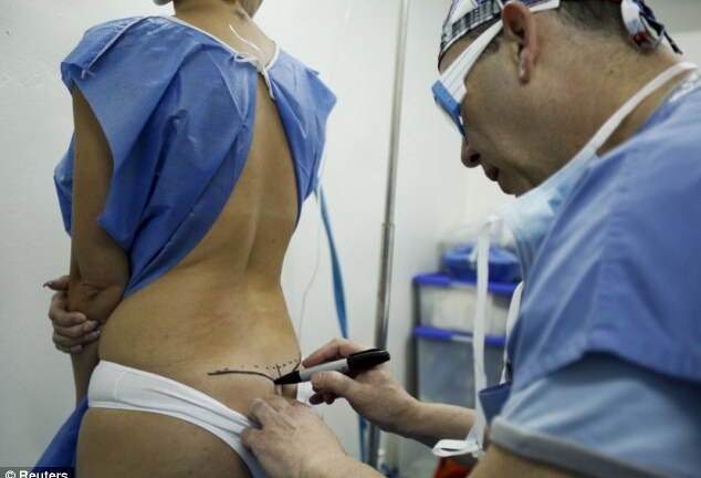 Cận cảnh quy trình tháo bỏ silicone lỏng độn mông, ngực