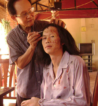 Hãi hùng với gương mặt như bị tạt axit của Hoài Linh