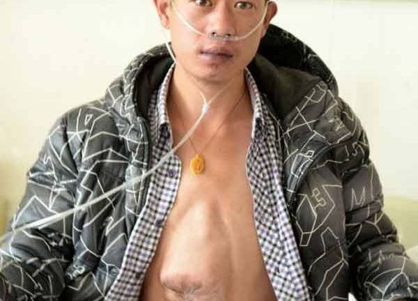 Kỳ lạ chàng trai trẻ có trái tim nằm ở... bụng