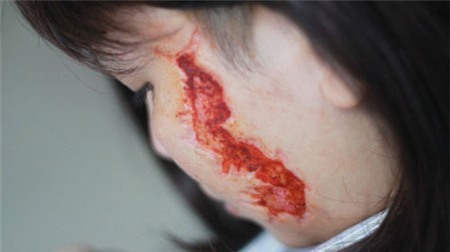 Đòn ghen kinh hoàng rạch nát mặt một phụ nữ