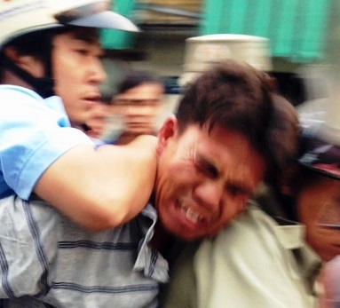 TP. HCM: Trật tự đô thị đánh người bán hàng rong ngất xỉu