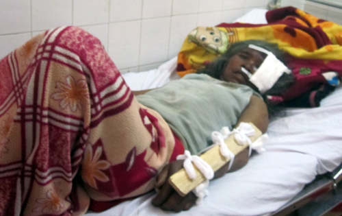 Gia Lai: Lật xe công nông, hàng chục người nhập viện