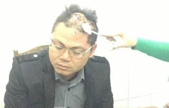 Mâu thuẫn mua nhà, chủ nhà bị chém tới tấp