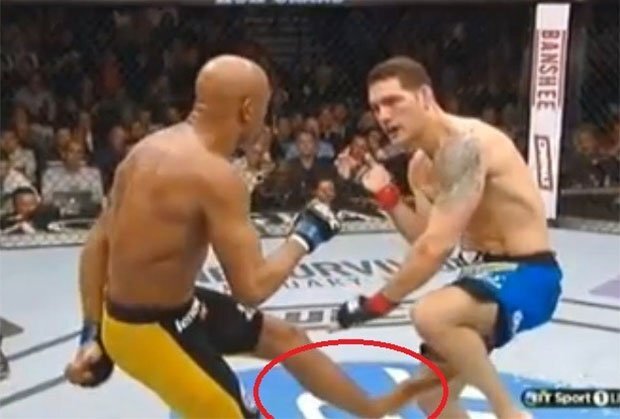 Video: Võ sỹ gãy gập chân vì đá đối thủ