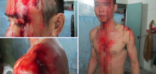 Thông tin nóng vụ côn đồ đâm chém lính đặc công dã man