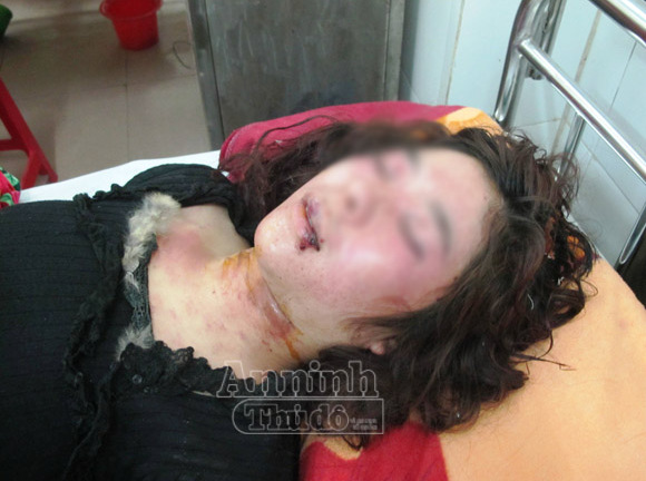 Bị đâm trọng thương, đánh gãy răng khi đang ngủ