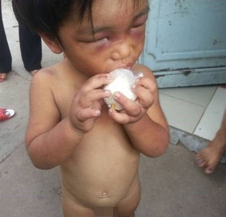 Những vụ bạo hành trẻ em kinh dị nhất Việt Nam