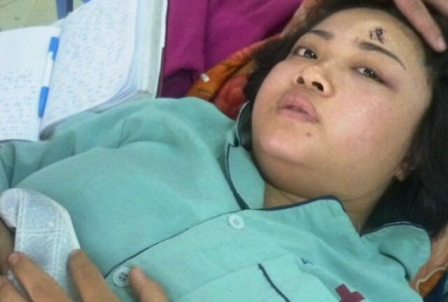 Bảo vệ BigC đánh nữ nhân viên tiếp thị nứt sọ não