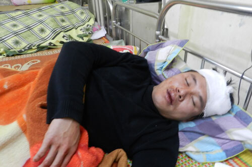 Bị đánh vỡ đầu vì nhắc nhở thanh niên ghẹo gái
