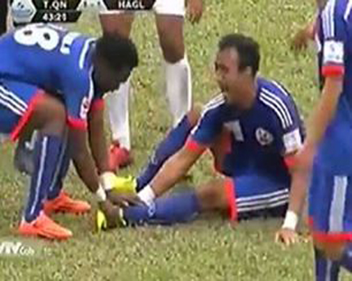 Sao V.League khóc thét vì bị đối phương đạp gãy chân