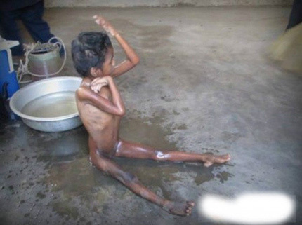 Cuộc chiến sinh tồn của cô bé 