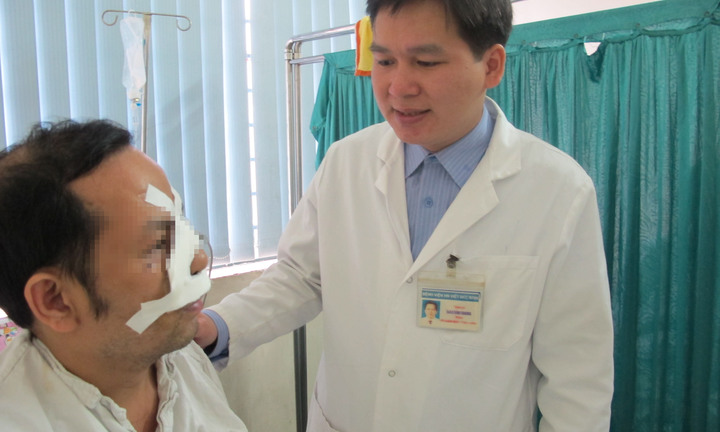 Nối thành công ca đứt mũi hy hữu