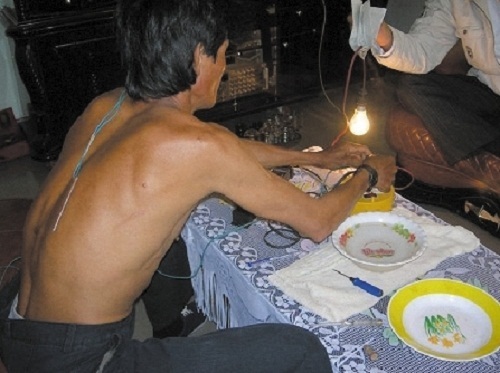 Lời giải về người đàn ông thoát chết rồi biến thành “người điện”