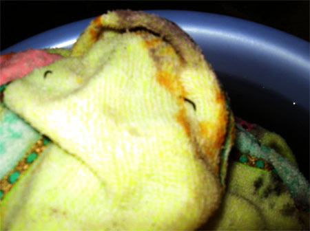 Đã có kết quả xét nghiệm vụ khăn tắm nở ra ấu trùng lạ