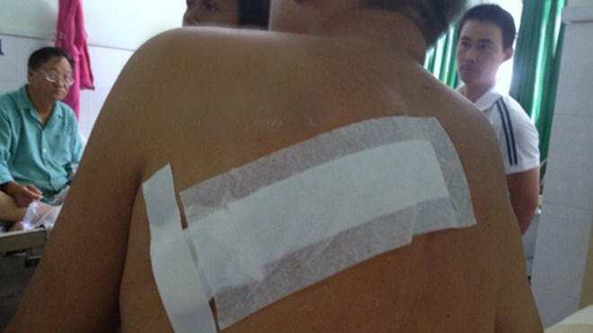 Đang ăn cơm bị côn đồ chém gục ngay trước nhà