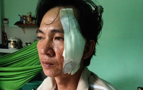 Giả cảnh sát kiểm tra giấy tờ để cướp