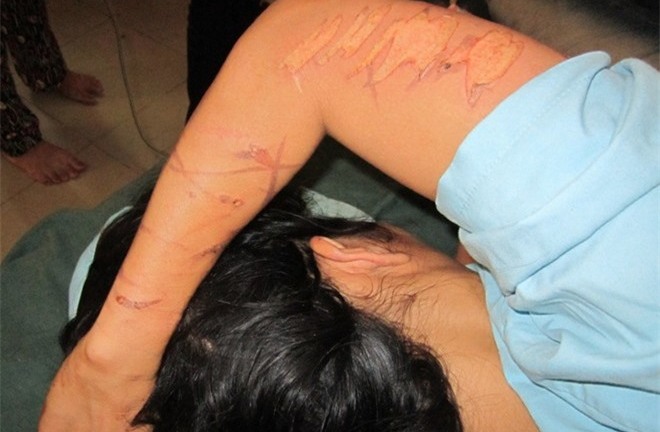 Điểm danh những vụ dùng “nhục hình” dã man như thời trung cổ