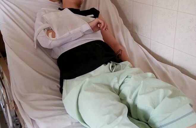 Hot boy Kelbin Lei gặp tai nạn nghiêm trọng vì bị cướp