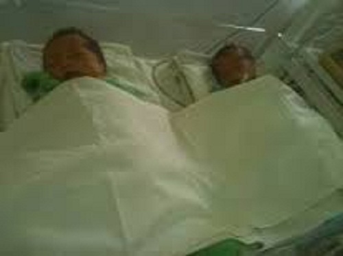 Cặp song sinh của sản phụ 15 tuổi đều tử vong